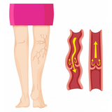 Ativador de Circulação Liberty 3D